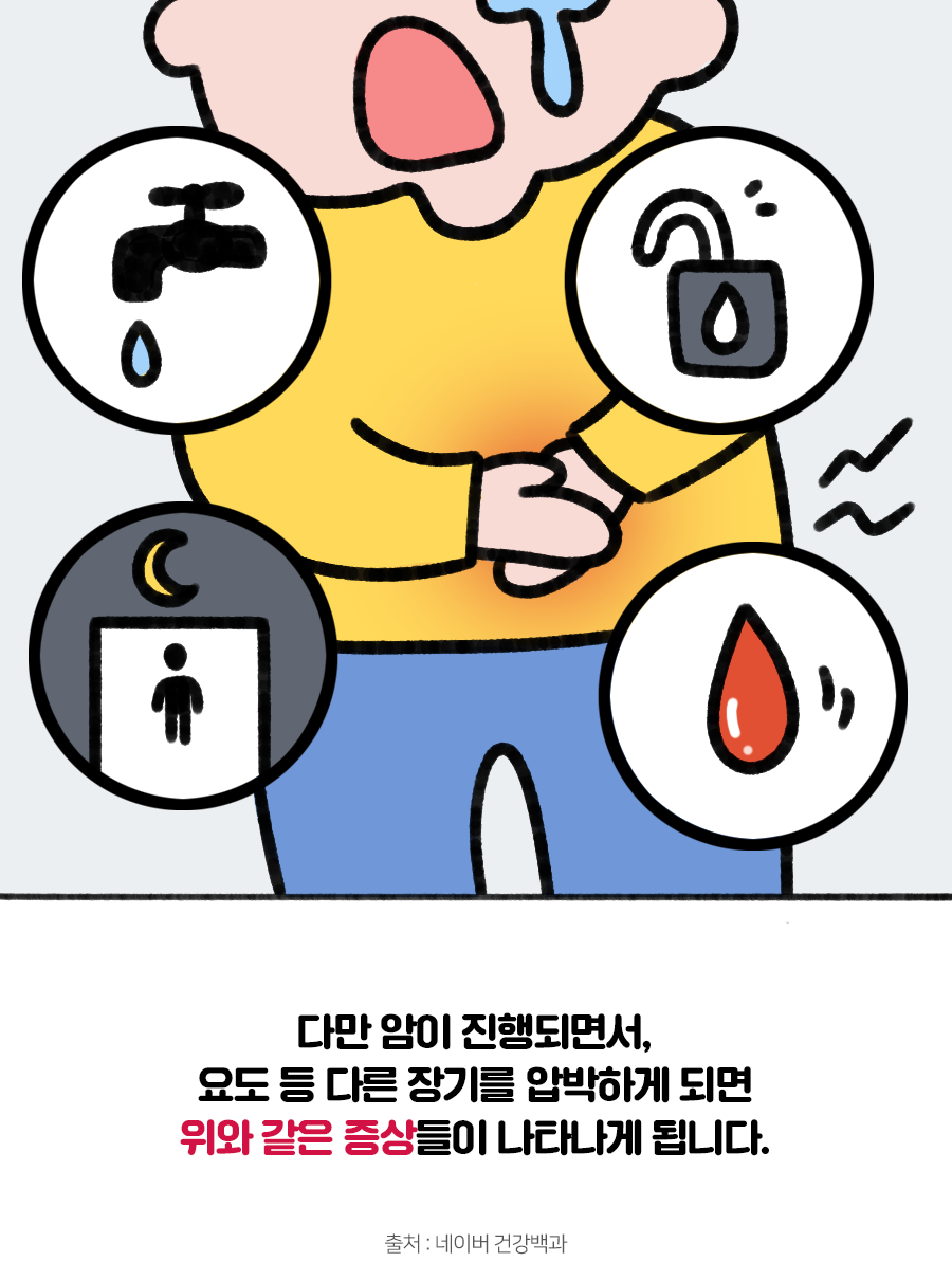 전립선 암-4