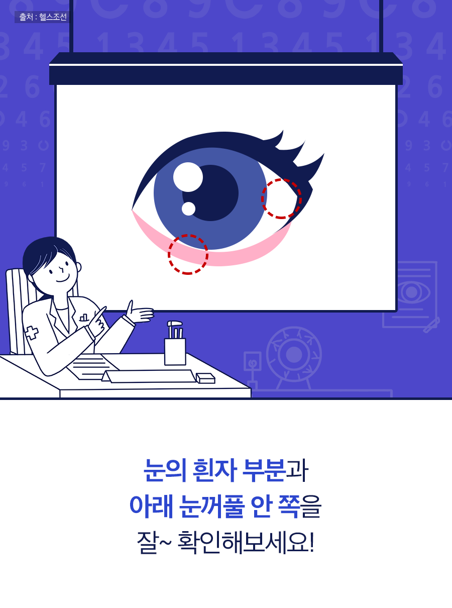 눈의 흰자 부분과 아래 눈꺼풀 안 쪽을 잘~ 확인해 보세요!