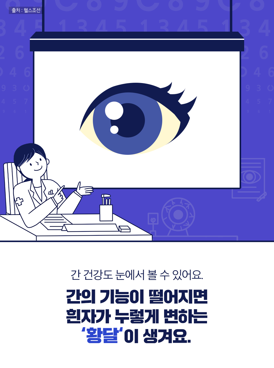 간 건강도 눈에서 볼 수 있어요. 간의 기능이 떨어지면 흰자가 누렇게 변하는 '황달'이 생겨요.