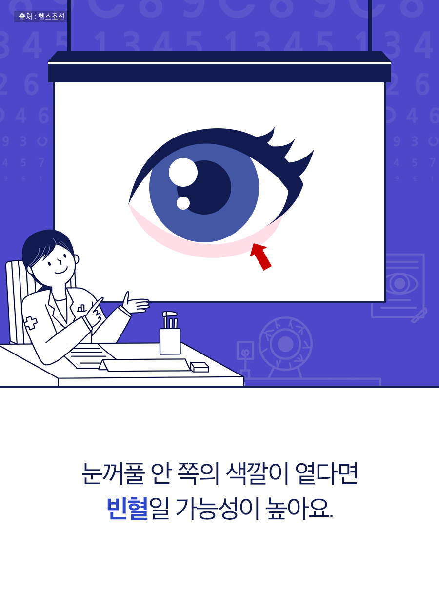 눈꺼풀 안 쪽의 색깔이 옅다면 빈혈일 가능성이 높아요.