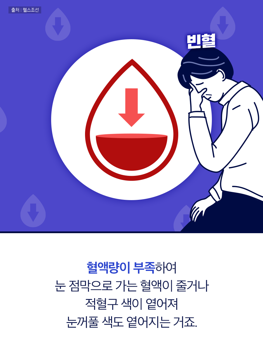 혈액량이 부족하여 눈 점막으로 가는 혈액이 줄거나 적혈구 색이 옅어져 눈꺼풀 색도 옅어지는 거죠.