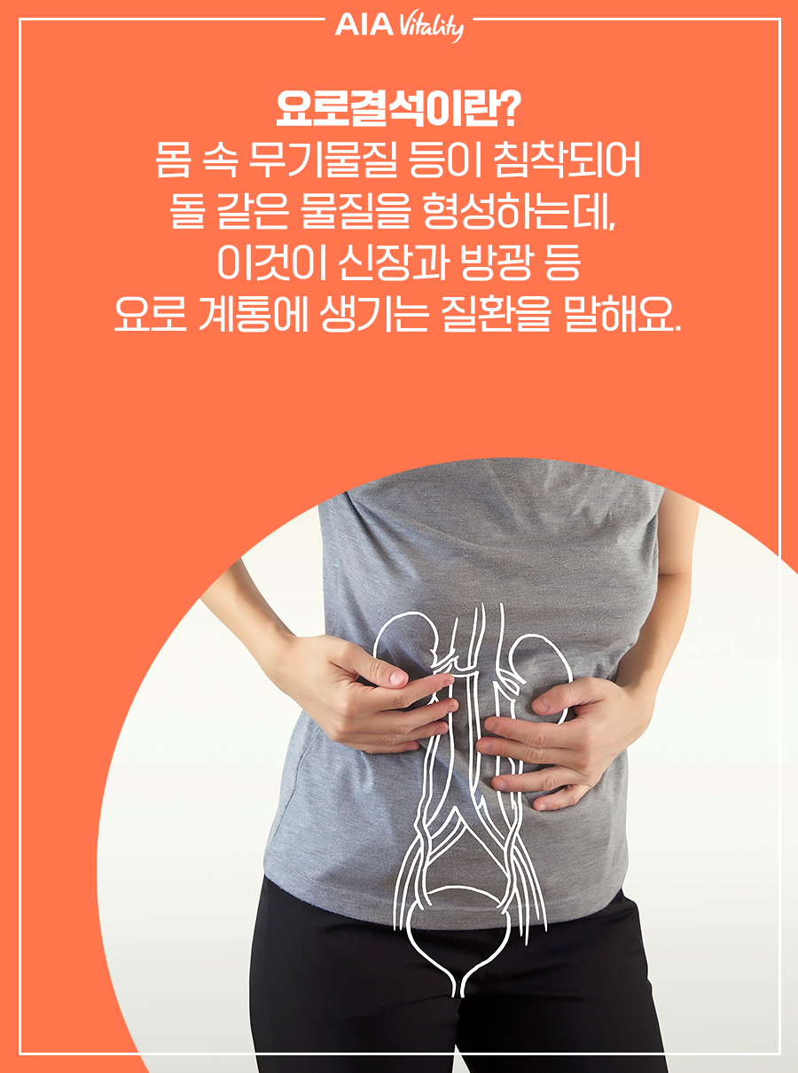 요로결석이란? 몸 속 무기물질 등이 침착되어 돌 같은 물질을 형성하는데, 이것이 신장과 방광 등 요로 계통에 생기는 질환을 말해요.